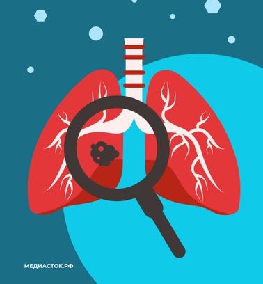 В Подмосковье ввели дополнительное обследование для курильщиков